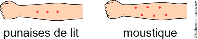 À gauche, un schéma de bras avec des points rouges alignés : Piqûres de Punaises de lit. À droite, un bras avec des points rouges éparpillés aléatoirement : Piqûres de Moustiques.